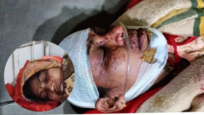 Jharkhand News: कोर्ट से लौटते वक्त जज की पत्नी को मारी गई गोली, SIT जांच में चौंकाने वाले आरोप